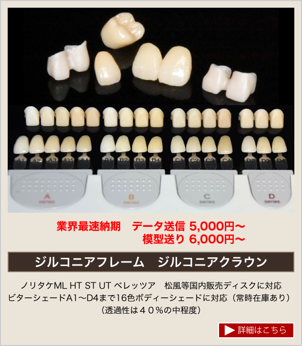 京都の歯科技工所｜ジルコニアフレーム製作なら【ツヤデンタル】