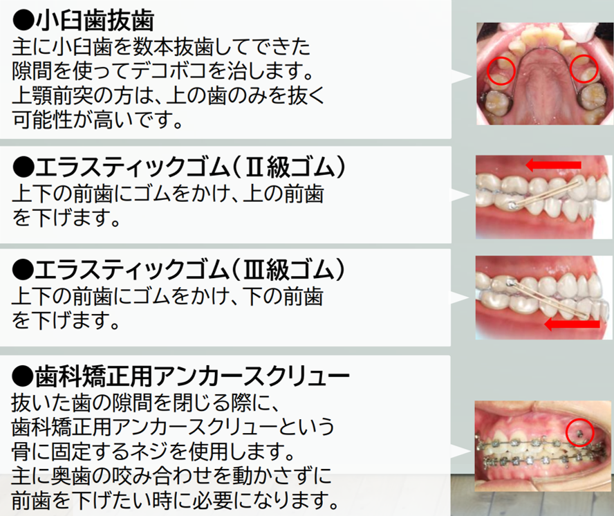 所沢の矯正専門医院 VAN矯正歯科|所沢駅徒歩1分