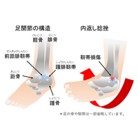 足首の捻挫（足関節靭帯損傷）にはRICE処置 | ヨミドクター(読売新聞)