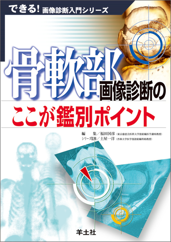 できる！画像診断入門シリーズ：骨軟部画像診断のここが鑑別ポイント