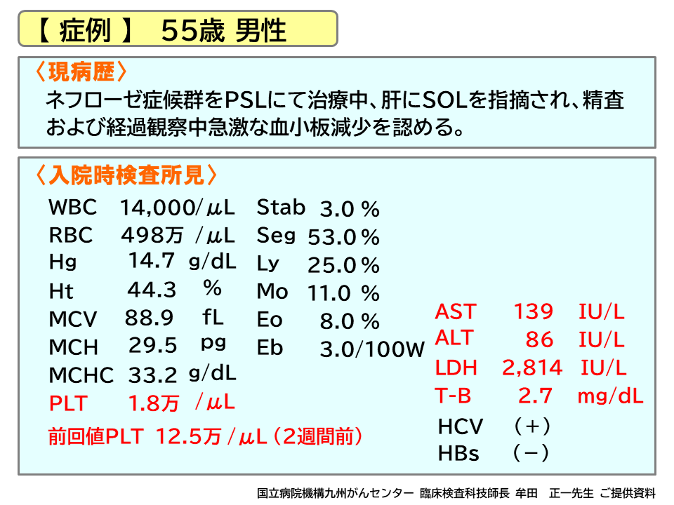 赤血球形態から推測される血液疾患』教科書には書いていない血球の目視