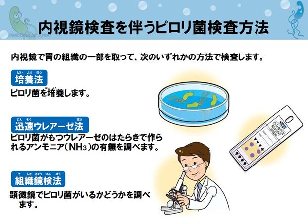 ピロリ菌の検査 | 岩国市尾津町の内科、胃腸科、消化器内科 | やました