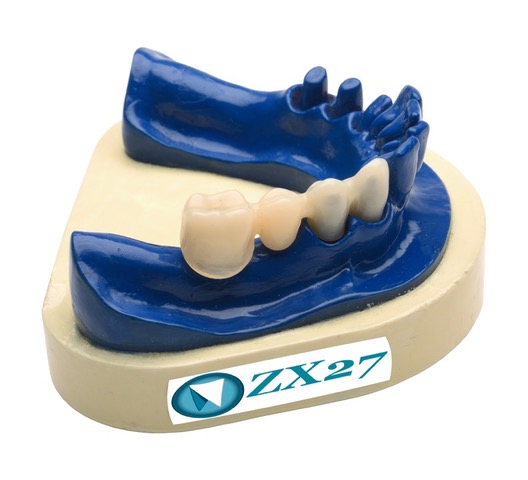 Exploring Your Options Instead of Dental Implants – ZX-27 – Non