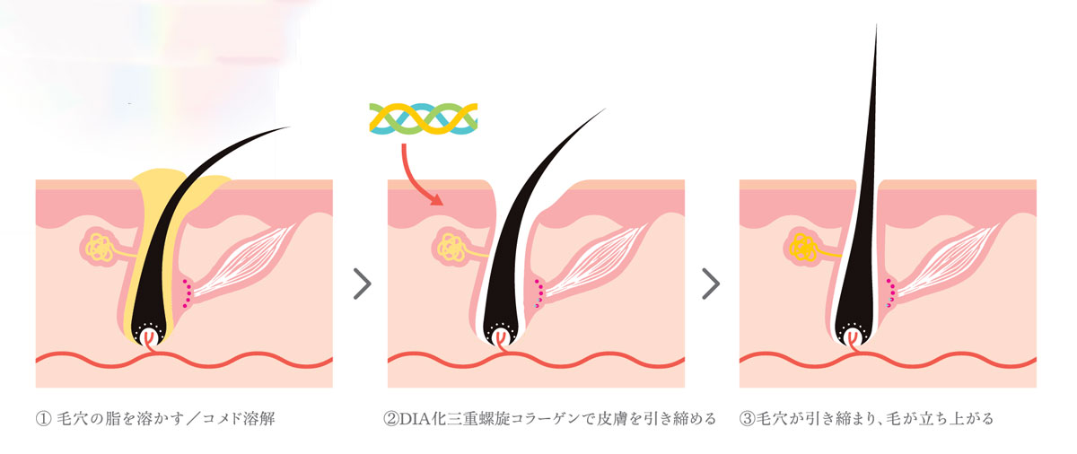 たった数分でボリュームアップ!? 新感覚の頭皮美容液が登場【NMN