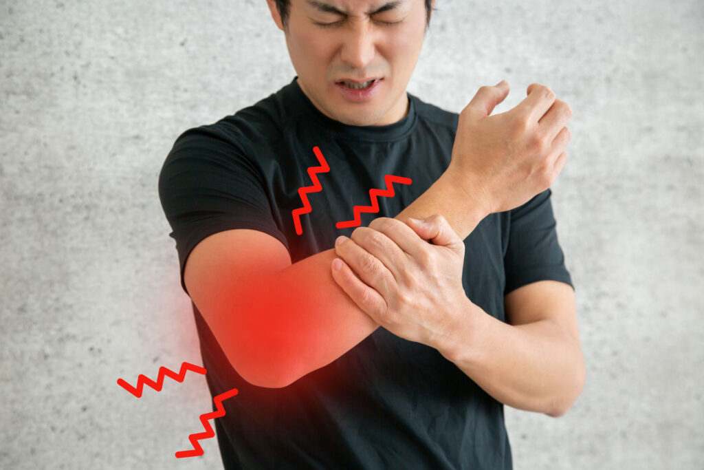 一宮市でテニス肘（上腕骨外側上顆炎）の改善なら｜はないけ接骨治療院