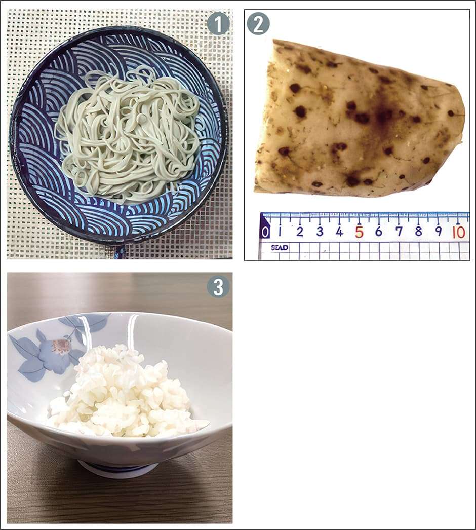 患者個々に沿う栄養指導——がん病態栄養専門管理栄養士