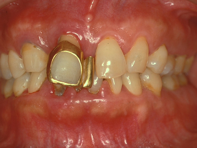 審美歯科｜山本歯科｜豊中市東泉丘桃山台駅の歯医者・歯科