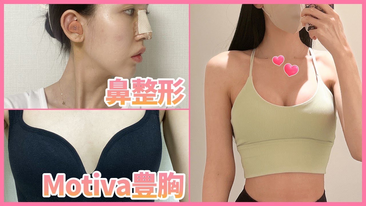 ピラティス講師のMotiva豊胸手術、鼻整形術後3か月のリアルレポ