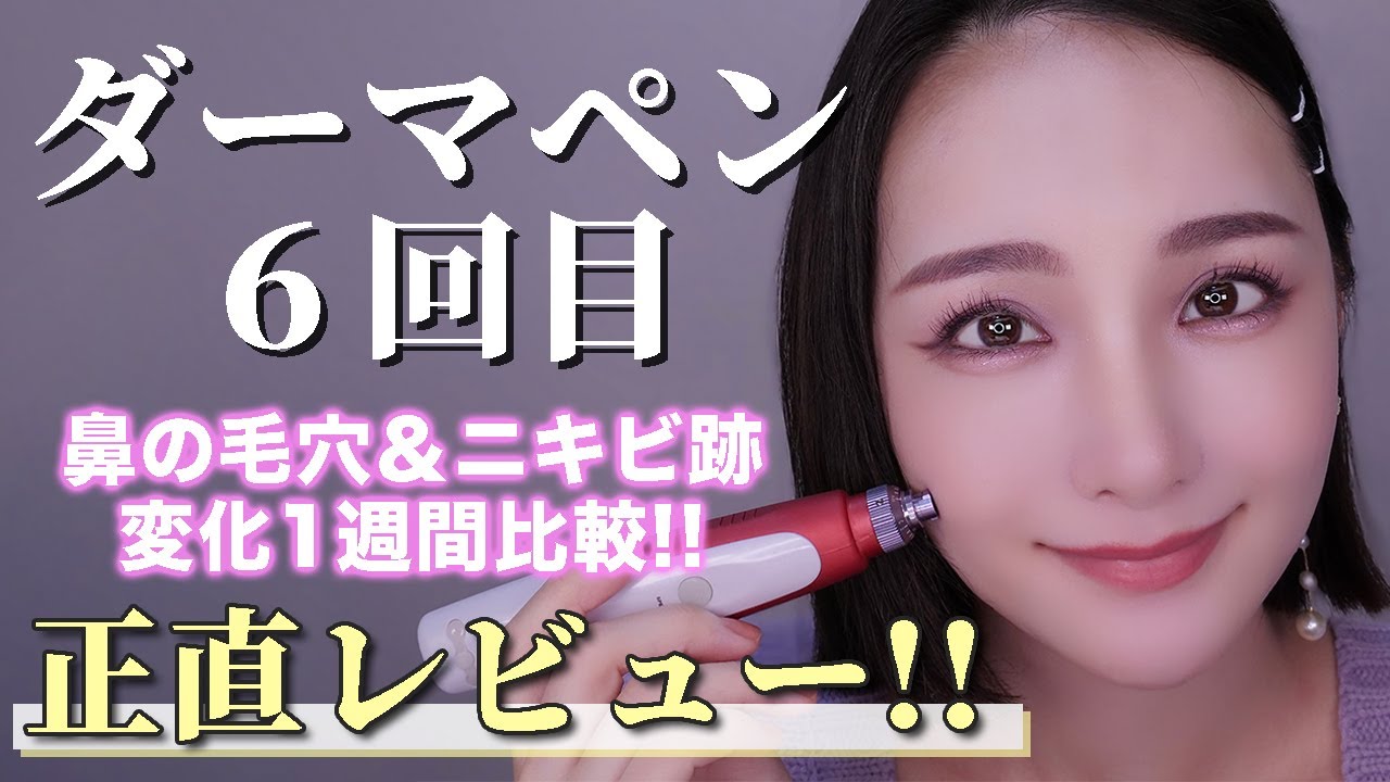 セルフダーマペン】6回目‼️毛穴＆ニキビ跡の変化約1週間高画質で比較