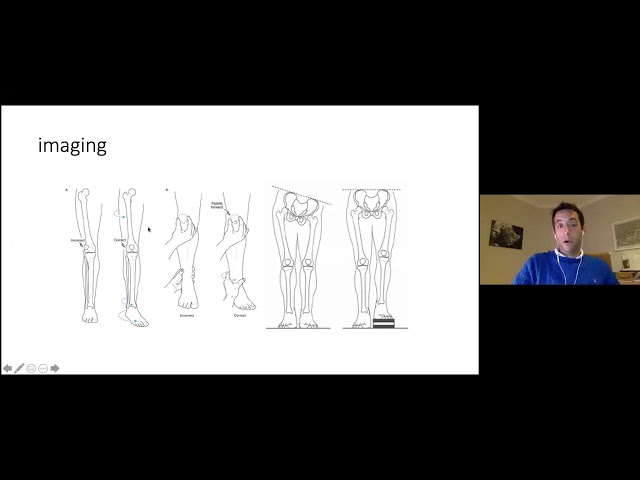 Principles of deformity correction for the FRCS - YouTube