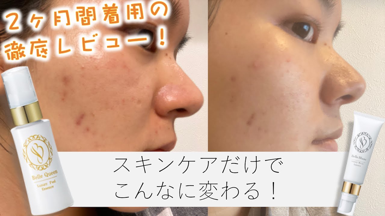 Belle Queen ベルクイーン エクソピール ベルブラン ベルクイーン