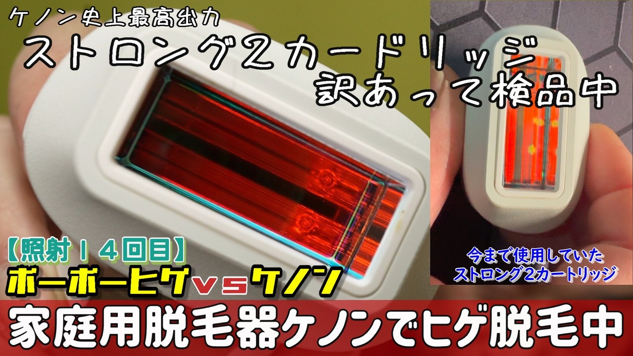 ボーボーヒゲvsケノン 家庭用脱毛器ケノンでヒゲ脱毛中【その9】照射14