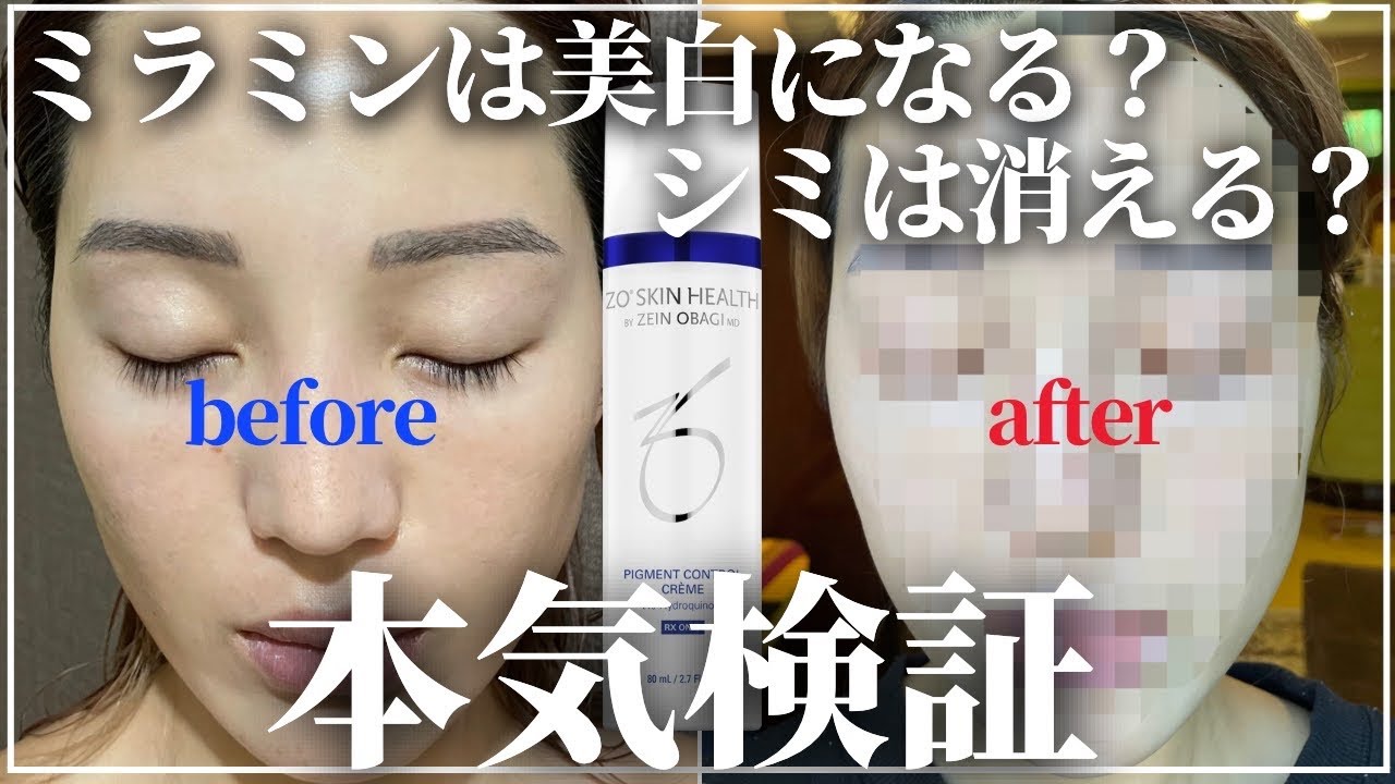 ゼオスキン ミラミン 残量9割 ゼオスキン ミラミン 残量9割 ミラミン