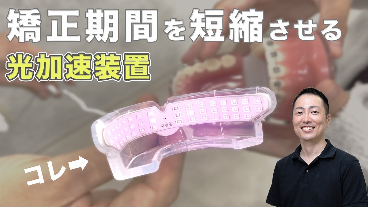 光加速装置】矯正期間を半分に！？PBMヒーリングの効果と使用方法