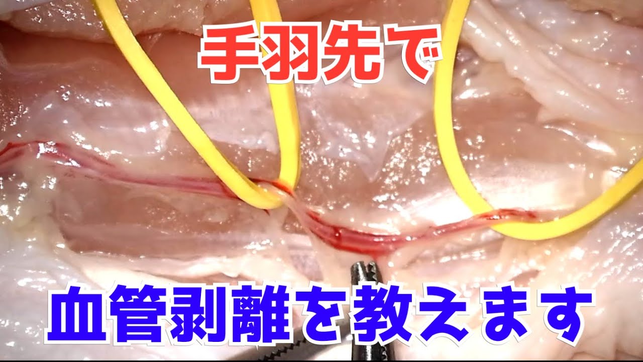 Microsurgery] Vascular dissectoion with chicken wing (English sub