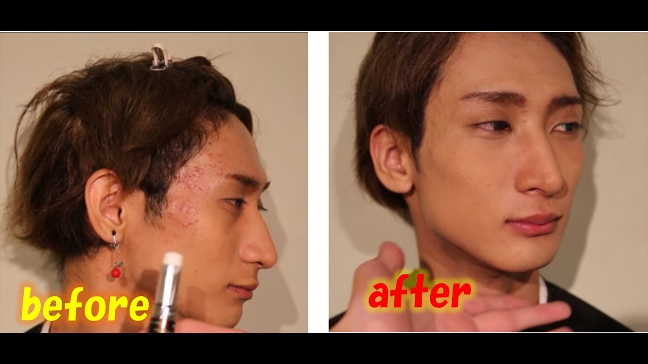 初めてのメンズメイクニキビ隠しできるメイク6点コンプリートセット