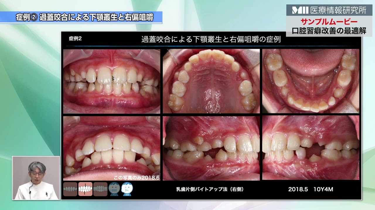 口腔習癖改善の最適解 | 医療情報研究所 DVD教材ストア