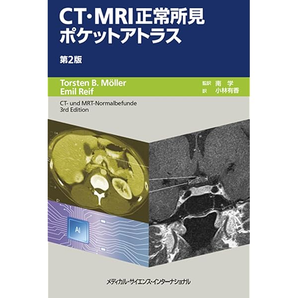 ジェネラリストを目指す人のための 画像診断パワフルガイド 第2版