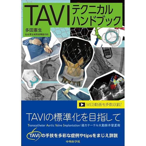 ステントグラフト内挿術マニュアル 腹部編【動画を含む電子版付