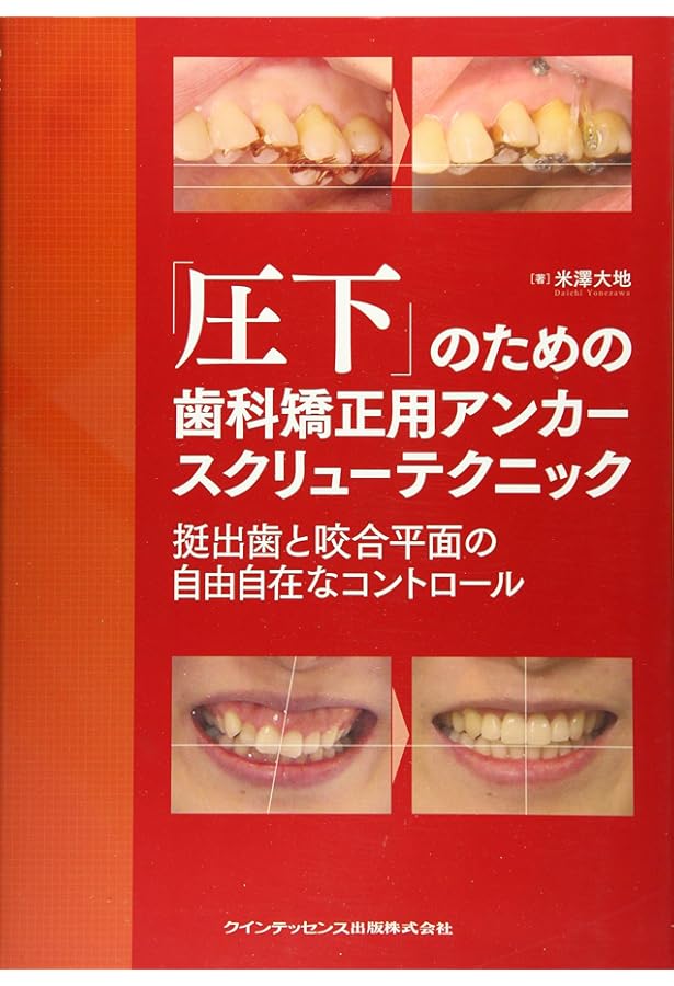 Amazon.co.jp: 部分矯正: その臨床応用のすべて : 米澤 大地: 本