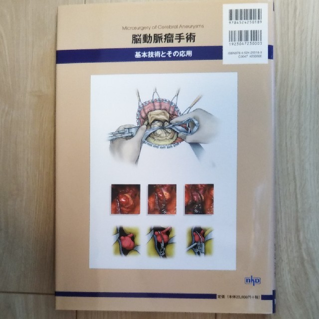 裁断済み 脳動脈瘤手術の基本技術と応用 脳動脈瘤手術 基本技術とその