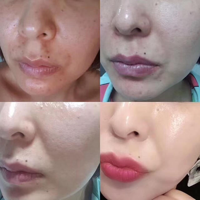 Incellderm インセルダム 3点セット 新品未開封 お買い得の通販 by と