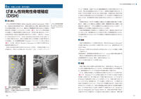 頚椎・胸椎の痛みと障害 筑田博隆(編) - 中山書店 | 版元ドットコム