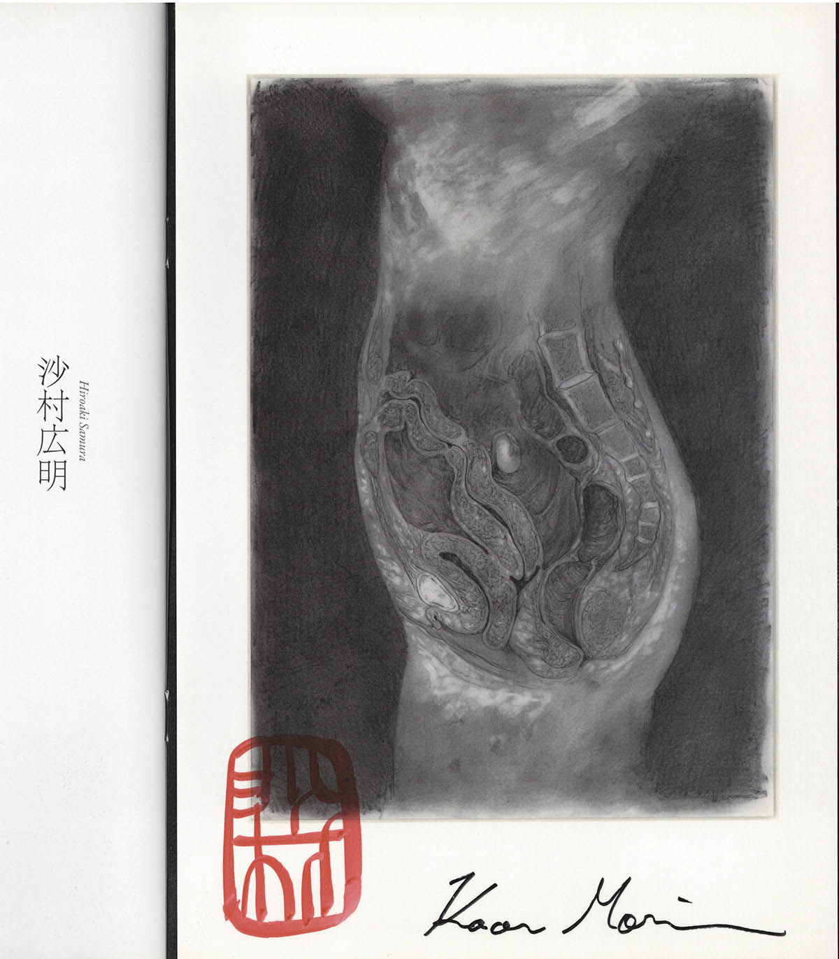 2204] 沙村広明/森馨 直筆サイン本「蹂躙史エピトマイザ -ある幻想の