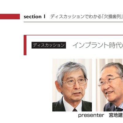 欠損歯列」の読み方,「欠損補綴」の設計