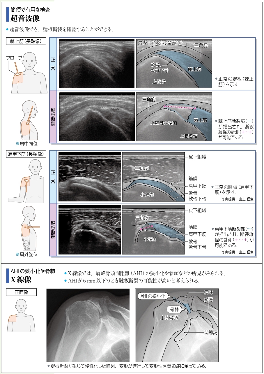病気がみえるvol.11 運動器・整形外科（第2版）』 改訂ポイント紹介