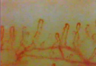 毛細血管スコープSC-10 – あっと株式会社