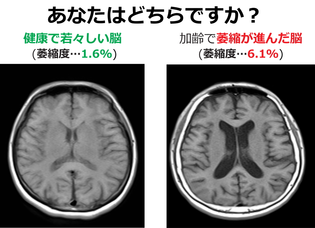 エムビジョン・ヘルス | 東京都目黒・品川の脳神経外科 | けやき脳神経