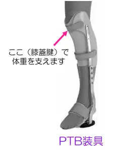 下肢の免荷装具｜PTB装具｜グラフィン装具｜アキレス腱断裂用装具