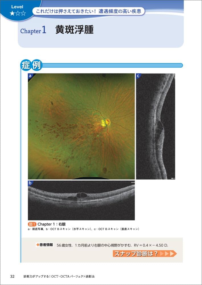 診断力がアップする！OCT・OCTAパーフェクト読影法〜正常・異常所見の