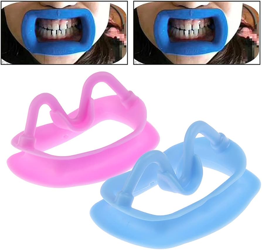 Amazon.co.jp: プロフェッショナル歯科リップ頬リトラクターマウス