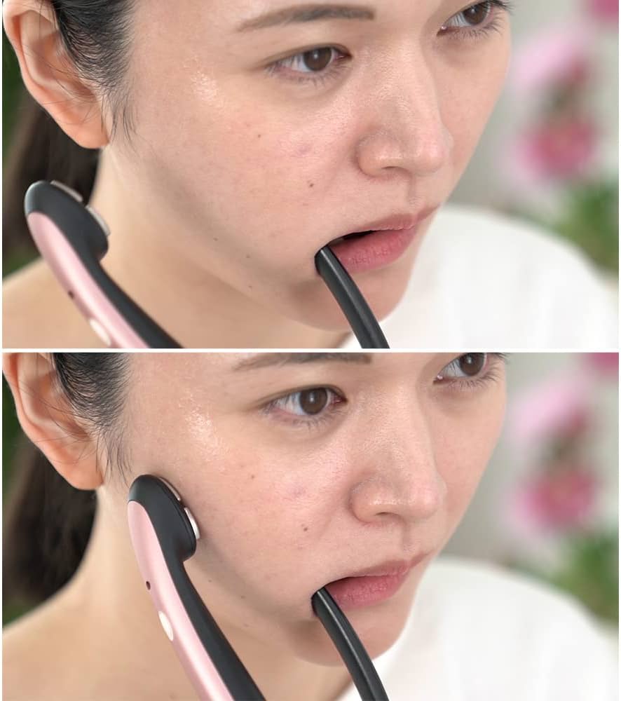 Amazon.co.jp: ディノス 美容 美顔器 ミリオンスマイル ターボ