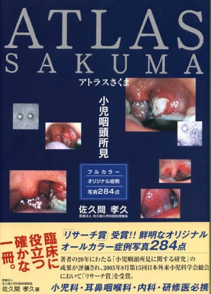 Amazon.co.jp: アトラスさくま: 小児咽頭所見 : 佐久間 孝久: 本