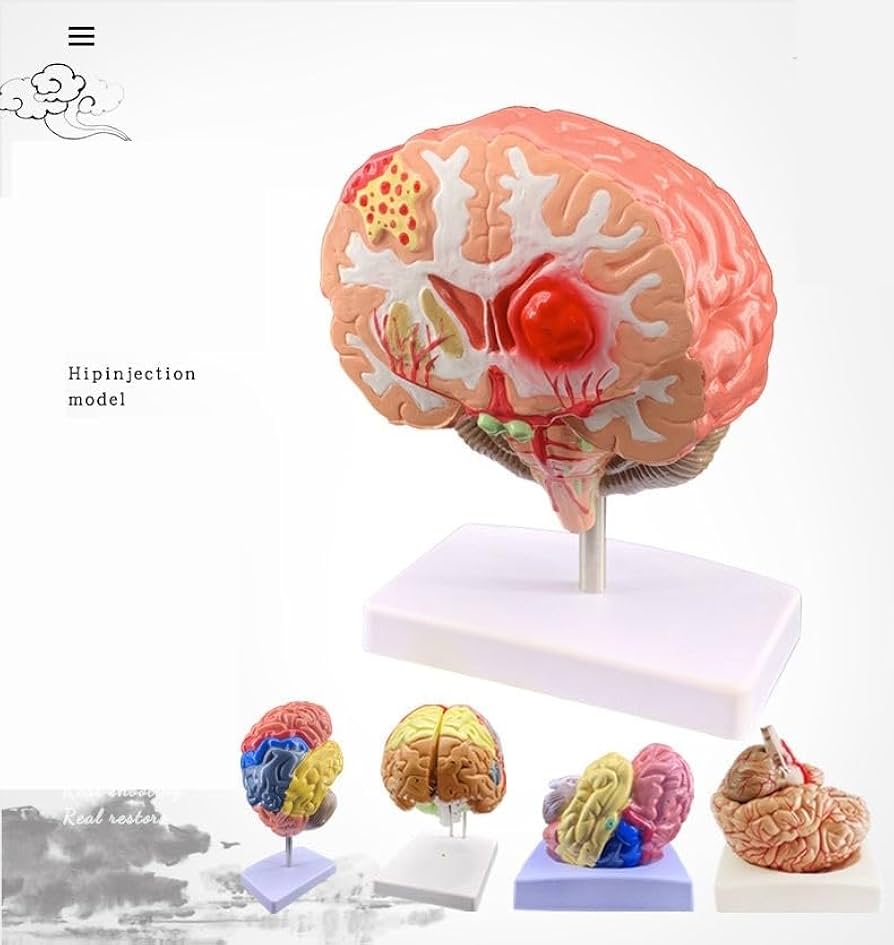 Amazon.co.jp: 脳 人体模型 脳モデル解剖学的脳動脈モデル 脳模型 解剖
