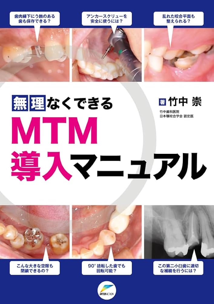 Amazon.co.jp: 無理なくできるMTM導入マニュアル : 竹中 崇: 本