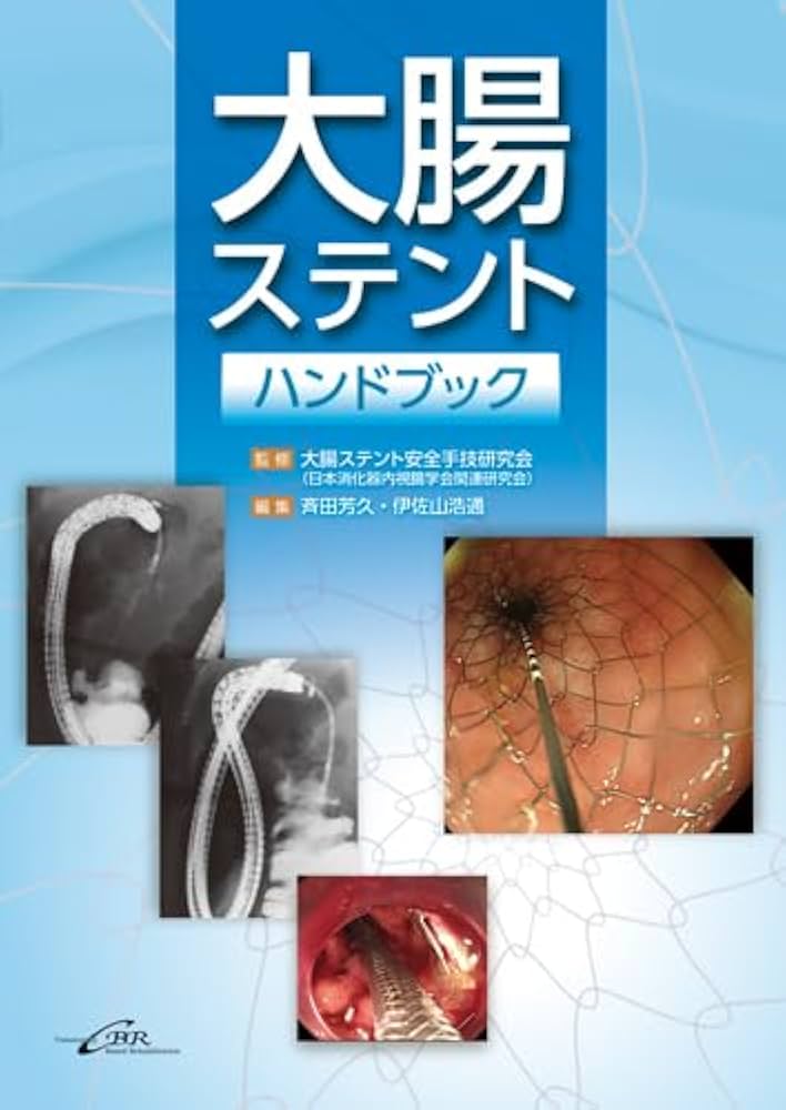 大腸ステントハンドブック | 斉田芳久・伊佐山浩通, 大腸ステント安全