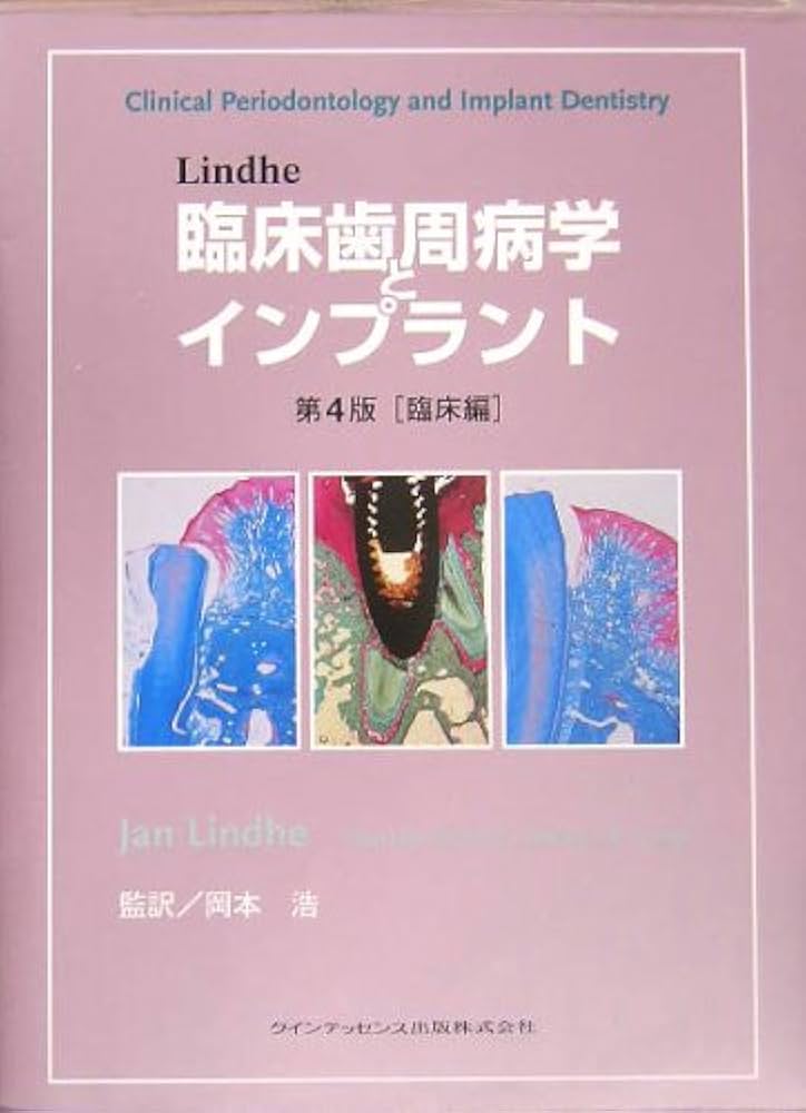 Lindhe臨床歯周病学とインプラント (臨床編) | Jan Lindhe |本 | 通販