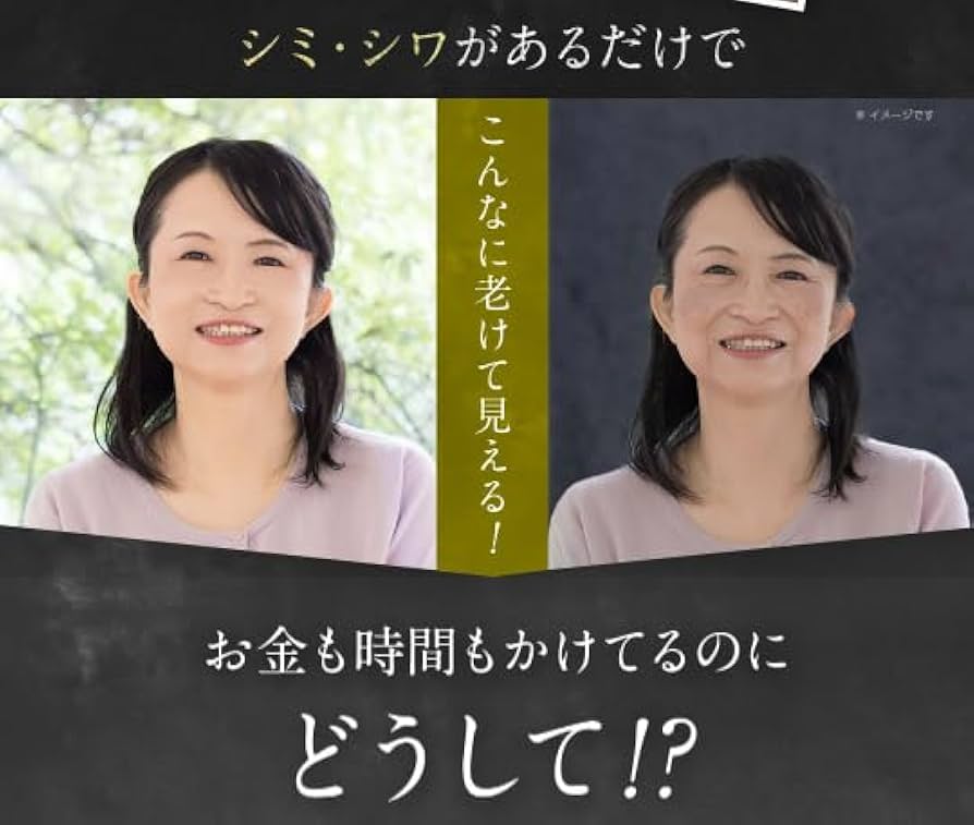 Amazon.co.jp: 【医薬部外品】キミエリンクルホワイト 薬用