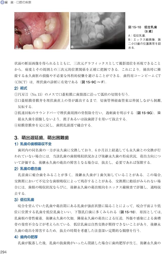 小児歯科学 第6版 | 白川 哲夫, 福本 敏, 岩本 勉, 森川 和政 |本