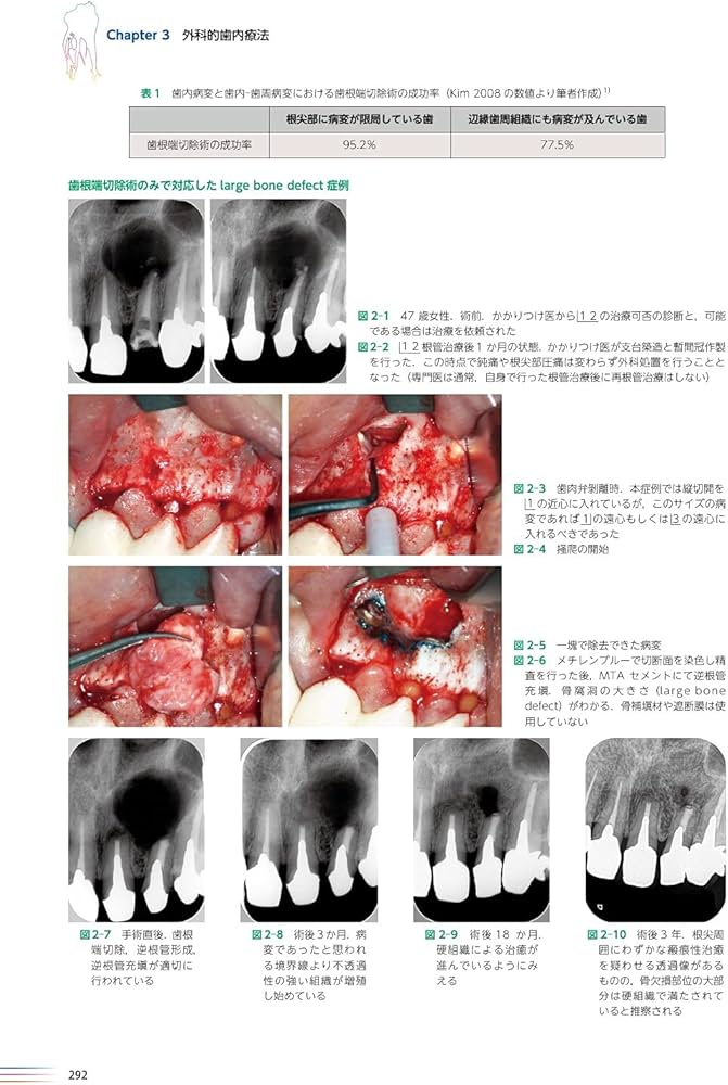 世界基準の臨床歯内療法 第2版 | 石井 宏, 石井 宏 |本 | 通販 | Amazon