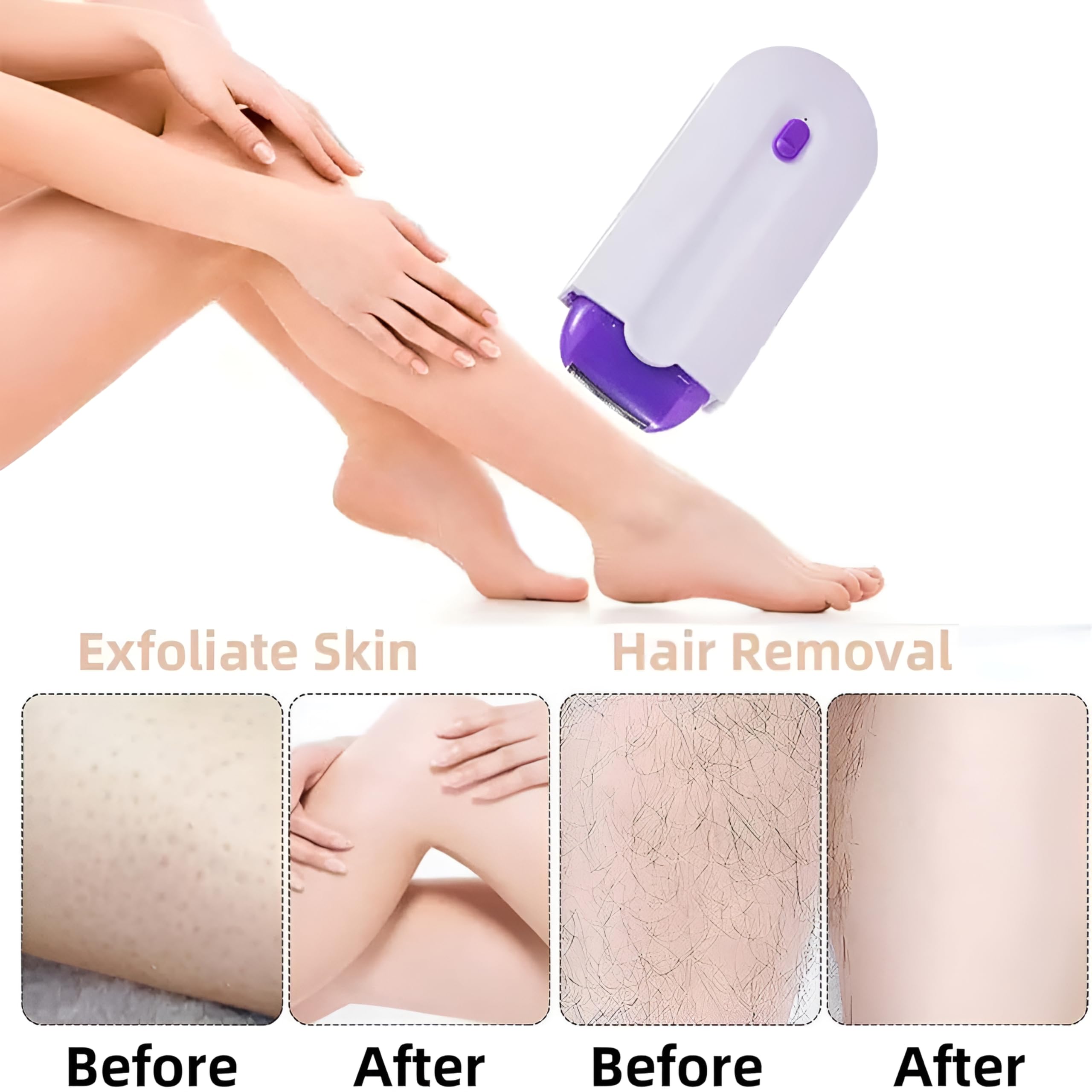 Amazon | レーザー脱毛装置 USB充電式女性脱毛器 ポータブル ライト