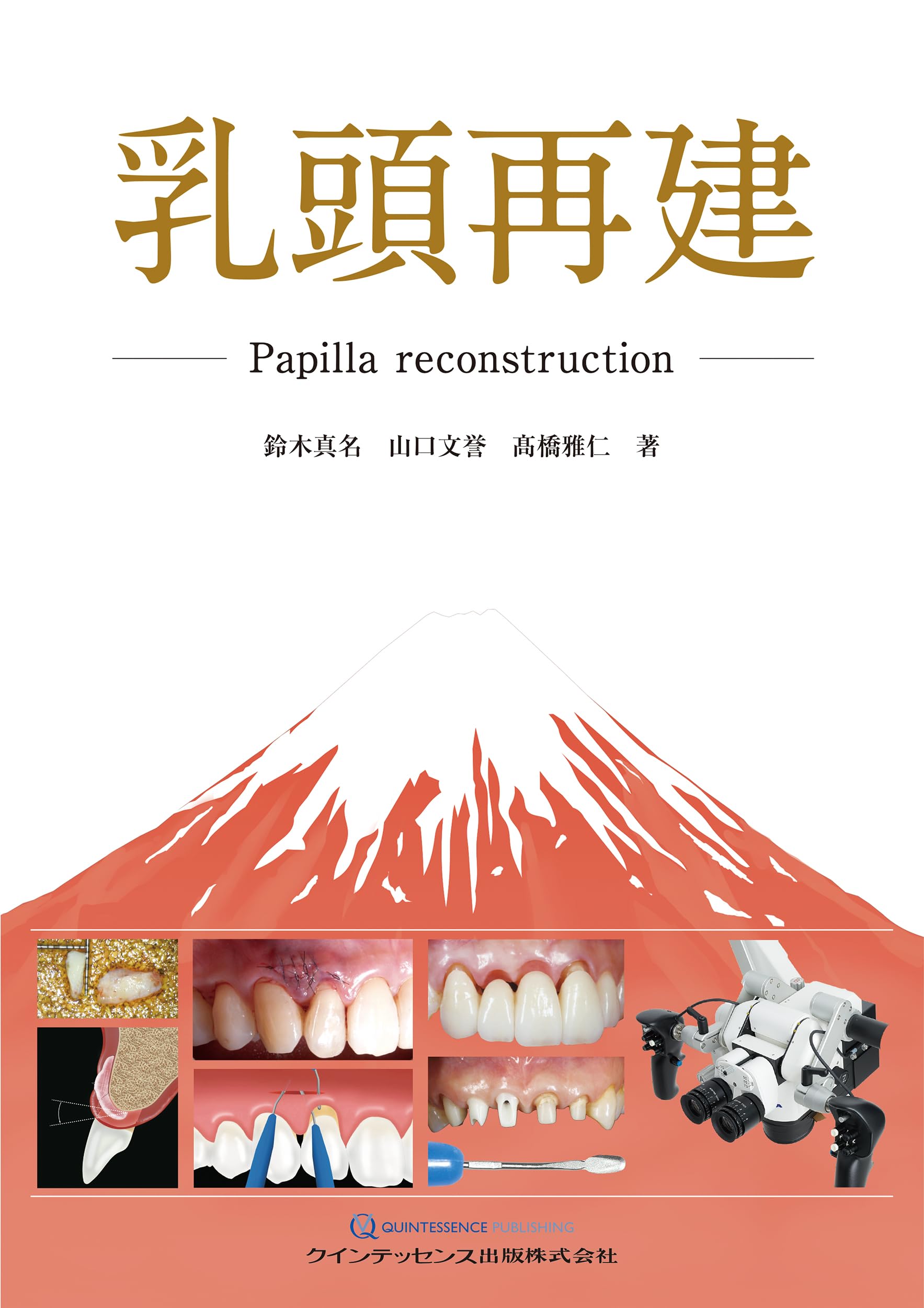 乳頭再建: Papilla reconstruction | 鈴木真名, 山口文誉, 髙橋雅仁