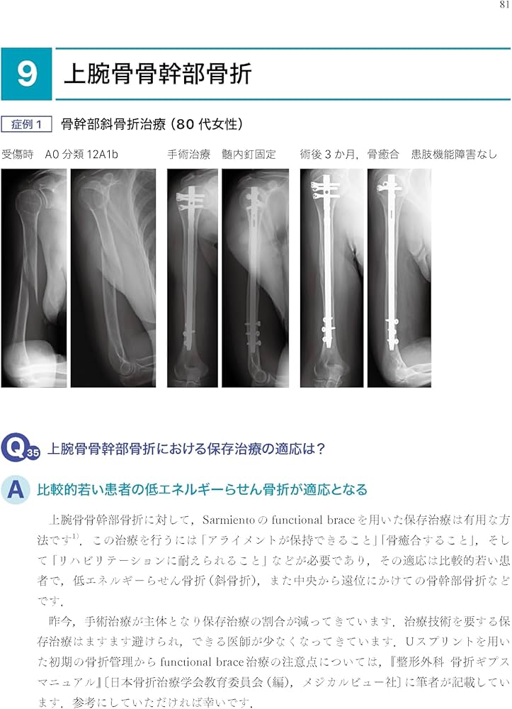 Amazon.co.jp: 「考える」外傷整形外科! : 土田 芳彦: 本
