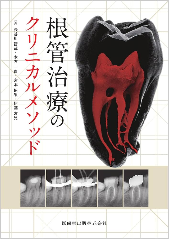 根管治療のクリニカルメソッド | 長谷川 智哉, 木方 一貴, 宮本 侑果