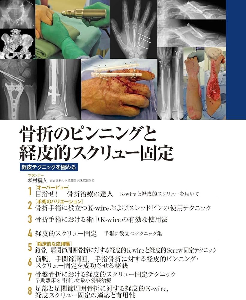 整形外科サージカルテクニック 2021年6号(第11巻6号)特集:骨折の