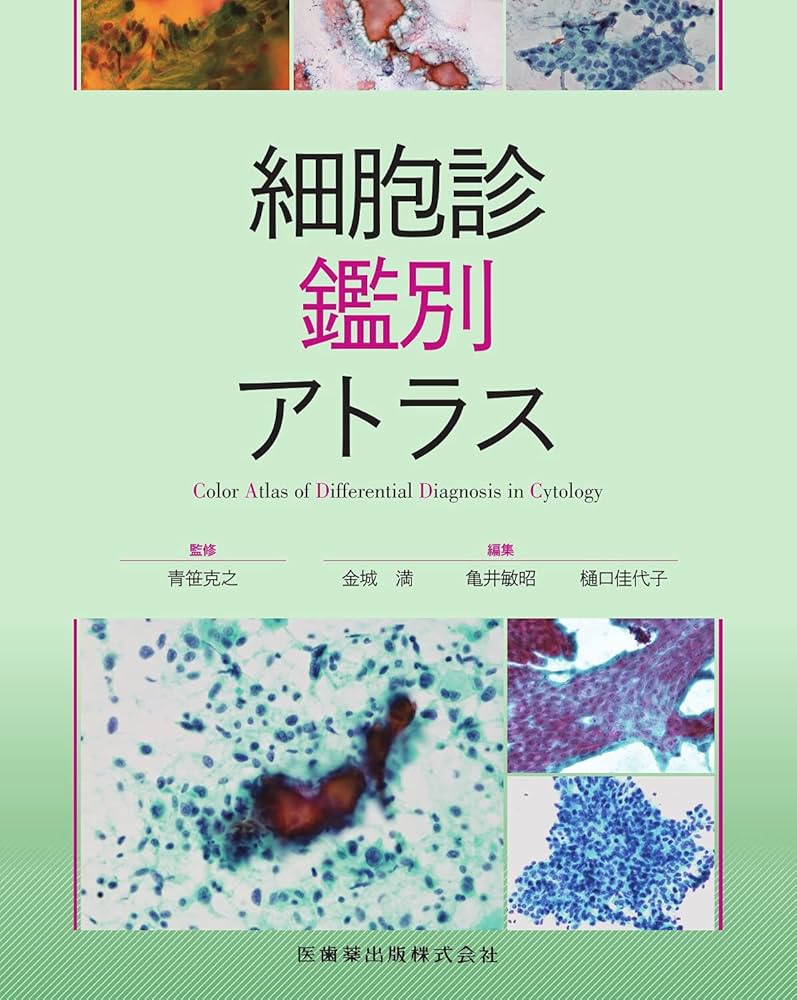 Amazon.co.jp: 細胞診鑑別アトラス : 金城 満: 本